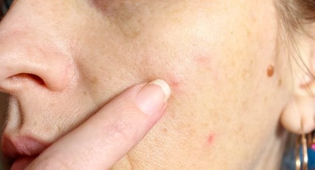 Gross Facts: 10 Things You Didn't Know About Your Skin